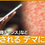 【SNS】はしか“自らかかりに”SNSで誤情報蔓延　昔の迷信「絶対ダメ」　医師が警鐘