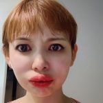 中川翔子、ひどいアレルギー症状を訴える「くちびる5倍になった」