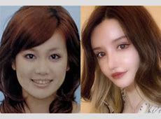 4000万円整形YouTuberの逆襲！誹謗中傷に怒った「こいつの高校に電話する」