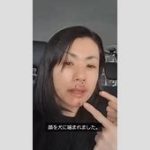 タレント・小島可奈子さんが犬に襲われた！医師が語る30針の傷の影響