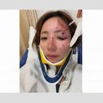 釣りアイドル・神野梓の事故とは？衝撃の現場を公開！